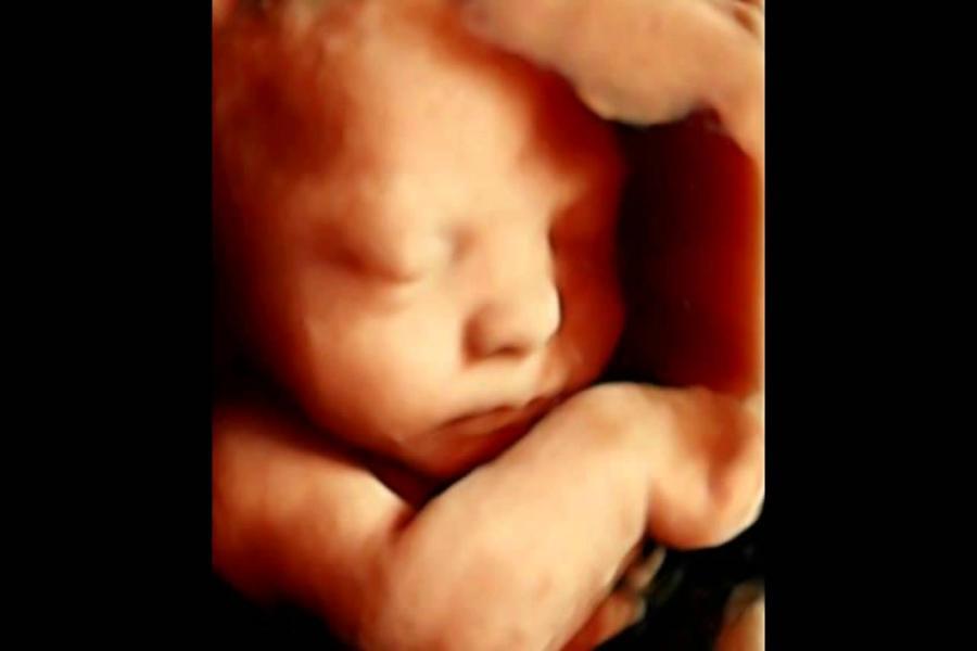 4d Hd Live Ultrasonografi